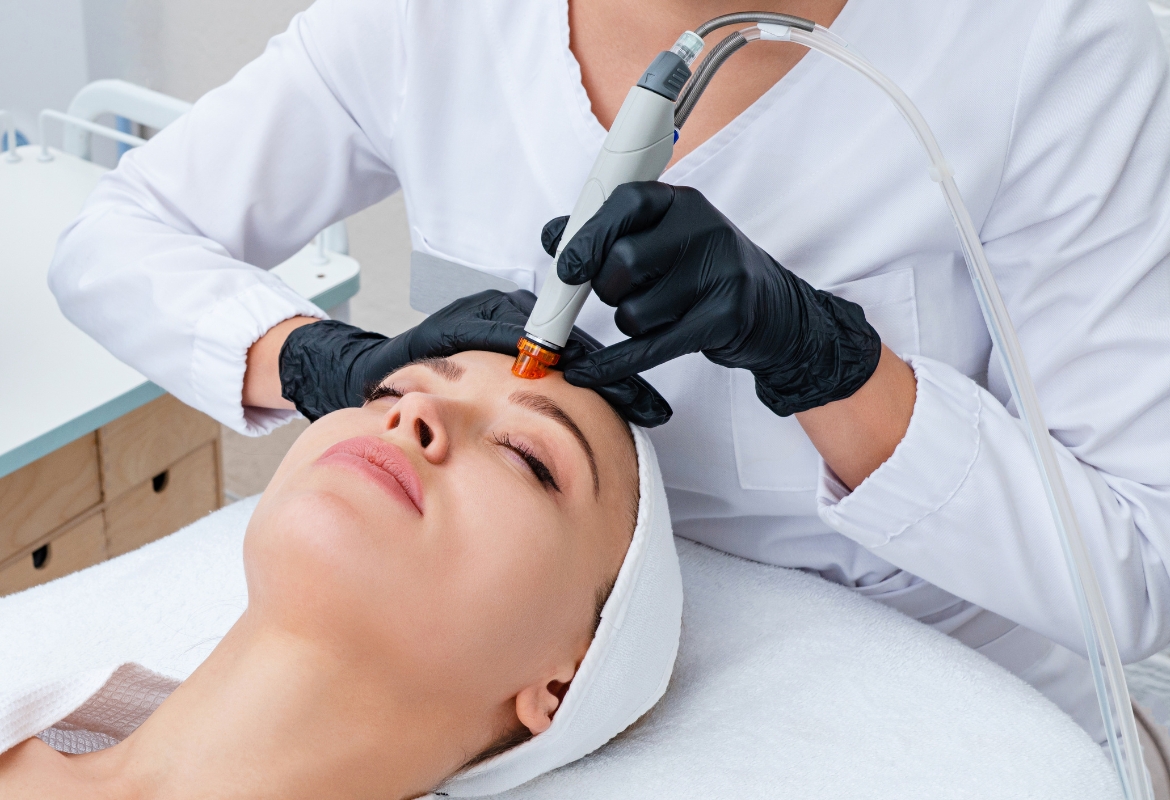 Why Hydrafacials Are the Most Requested Treatment This Summer (1)